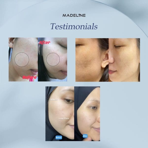 Madeline 100 seconds Daily Mask (3pcs) - Image 5