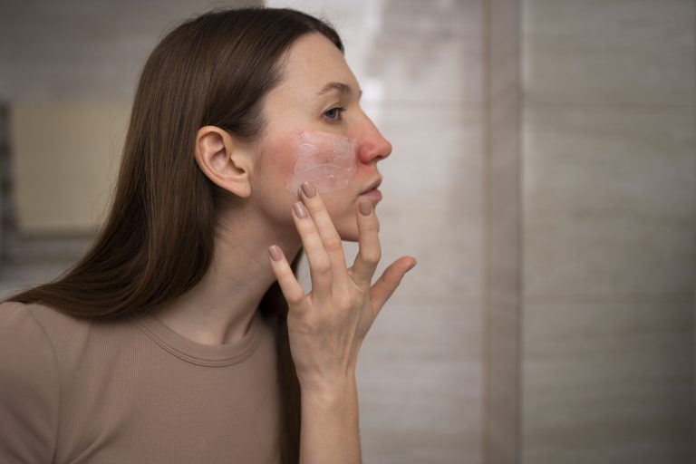 woman-using-moisturizer-help-with-rosacea-skin-condition